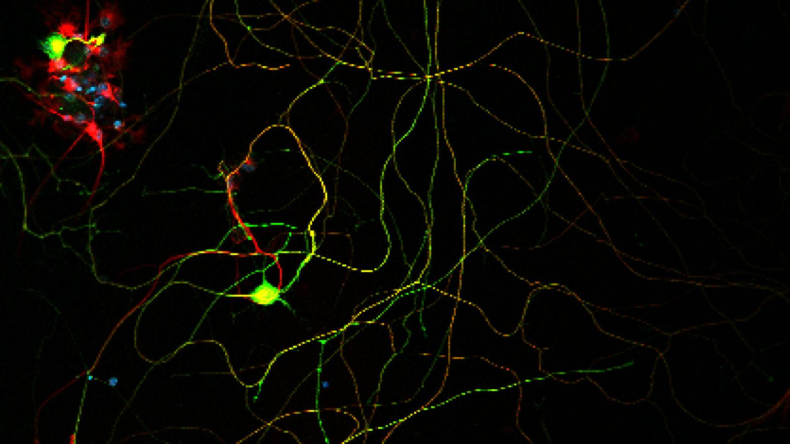 Dr. Quinzii and Dr. Akman, Merritt Center