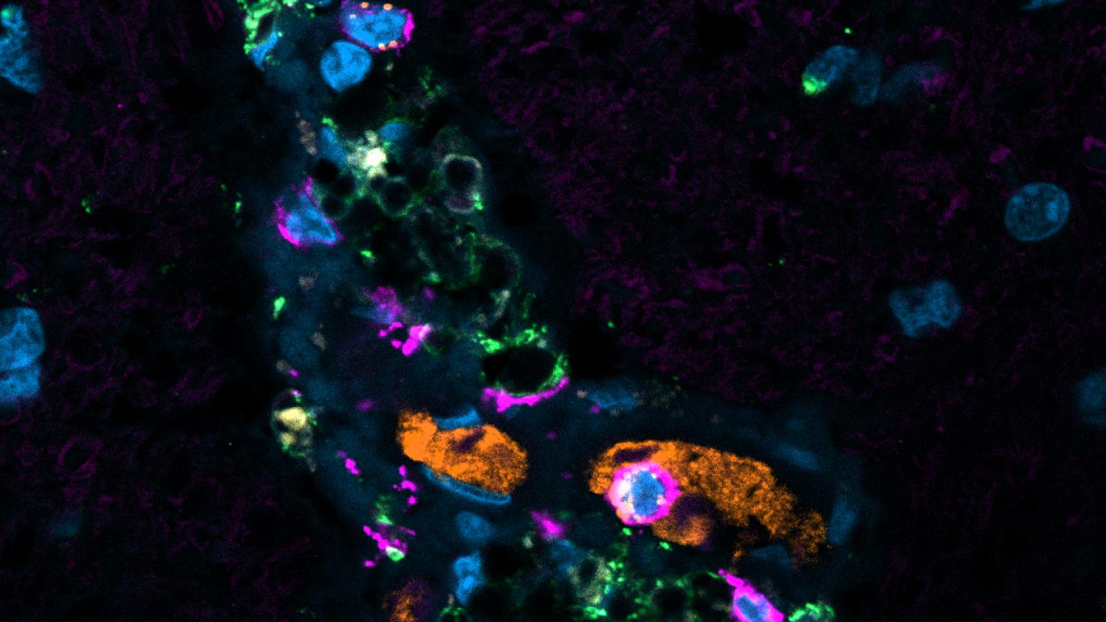 Translational Neurobiology research image 4