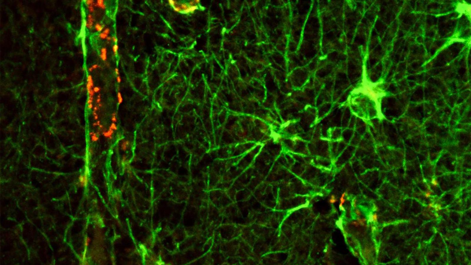 Glial cells forming an interconnected web with highlighted blood vessels in red fluorescence in a post-mortem brain section of an Alzheimer's patient. From Kizil Lab, CUIMC.