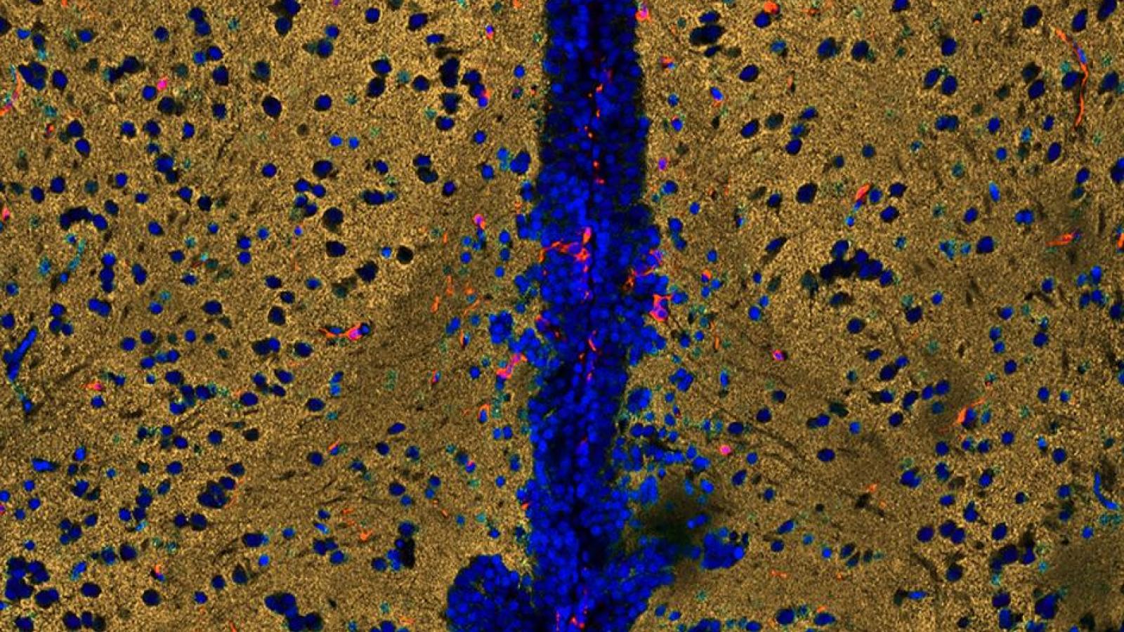 A cross-section of the zebrafish brain showing synaptic vesicles in gold, immune cells in red, and cell nuclei in blue fluorescence. From Kizil Lab, CUIMC.