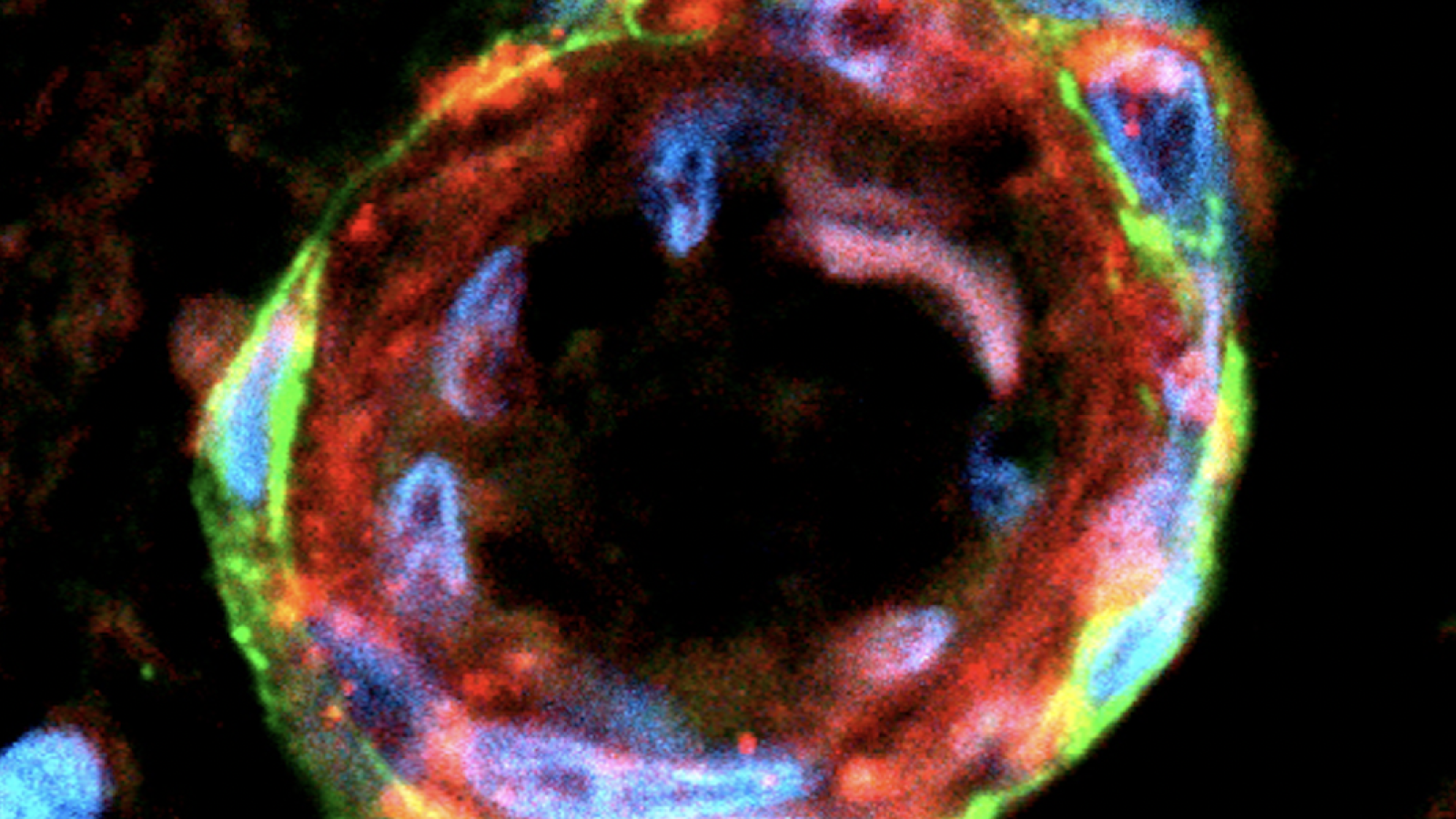 A high-resolution fluorescent image of a blood vessel cross-section in human brain, highlighting individual cellular layers and pathological protein deposition in red. From Kizil Lab, CUIMC.